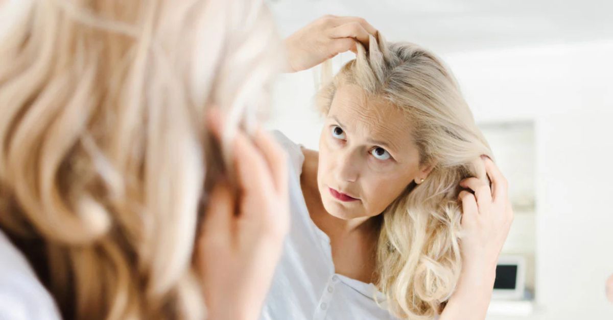 chute de cheveux chez la femme
